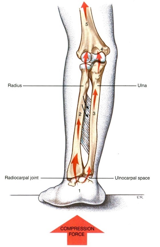 A membrana interossea stabilizáló szerepe, erőátvitel a radius és az ulna között tenyértámasz során