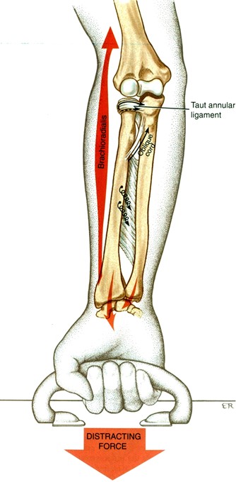 A membrana interossea stabilizáló szerepe, erőátvitel a radius és az ulna között nyújtó erő hatása (súly hordása) során