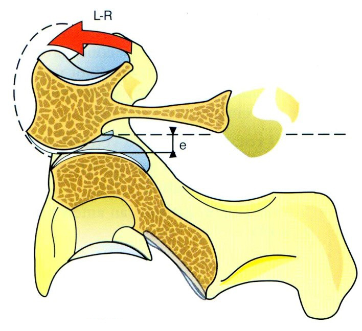 Rotáció az atlanto-axialis ízületben, az atlas vertikális elmozdulása rotáció során (e)