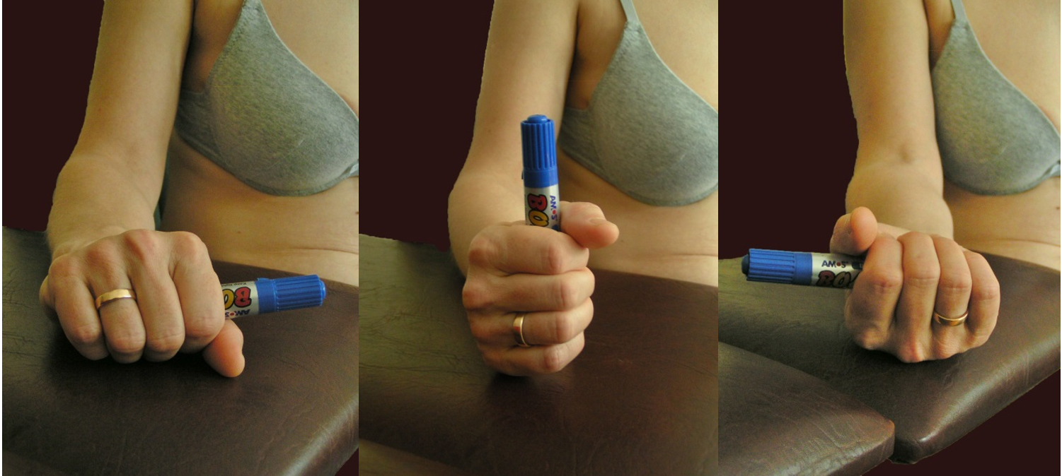 Alternatív vizsgálat az alkar pro-szupinációs mozgásterjedelmének megítélésére. A kézben tartott toll, mutatja a mozgásterjedelem mértékét.