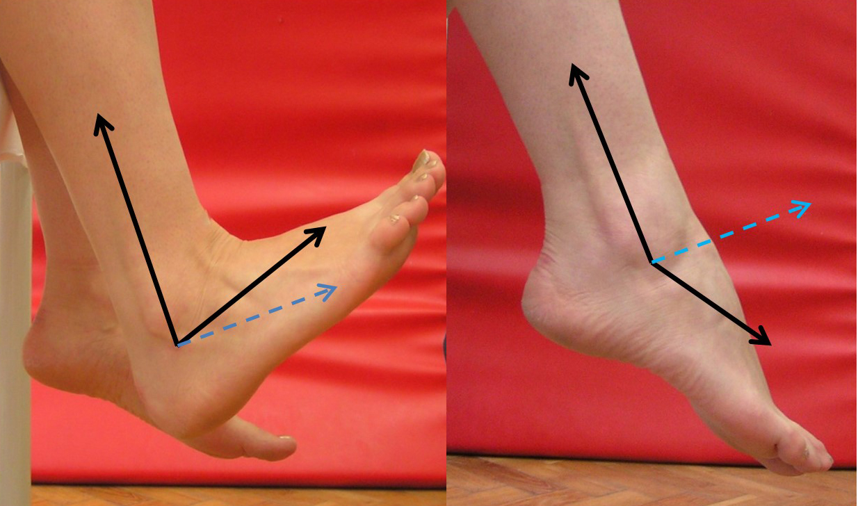A bokaízület dorzálflexiója (1. kép) és plantárflexiója (2. kép).  Neutrális helyzetben a lábszár hossztengelye és a talp síkja (kék nyíl) 90 –os szöget zár be.
