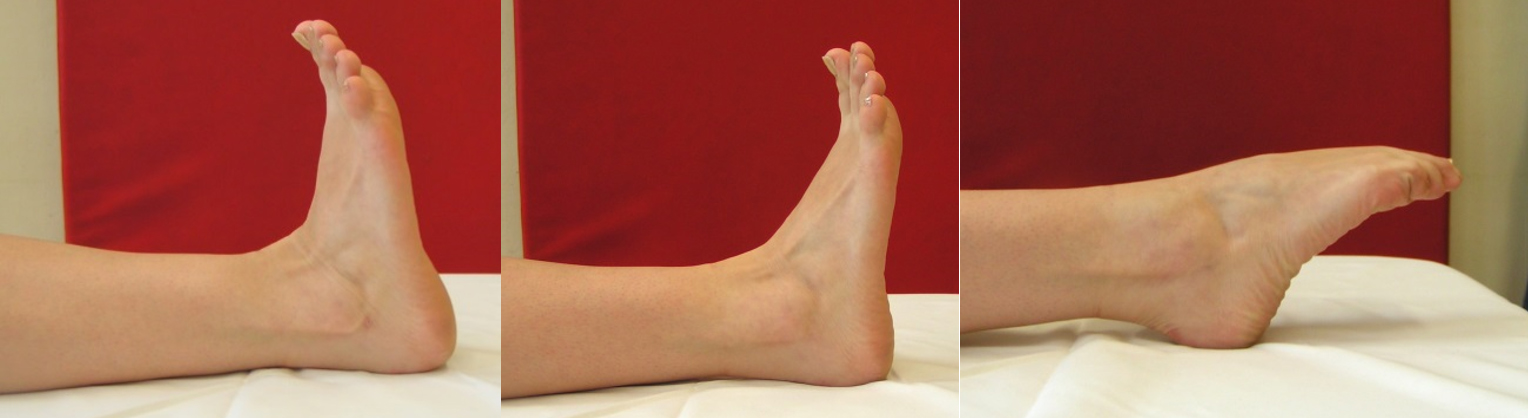 A bokaízület mozgásainak vizsgálata hátonfekvésben: dorzálflexió (1. kép), neutrális helyzet (2. kép), plantárflexió (3. kép)