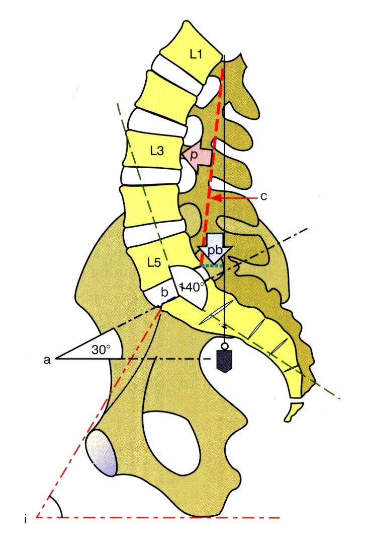 A medence és a lumbosacralis gerinc jellegzetes szögei A sacrum dőlési szöge (a) A medence dőlési szöge (i) A lumbosacralis szög (b)