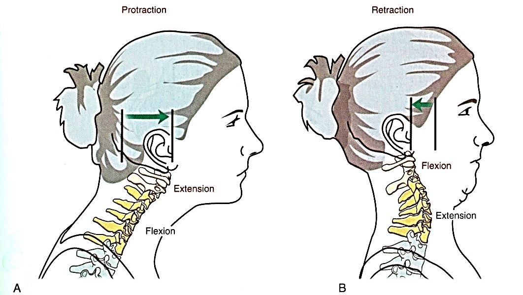  Protrakciós fejtartás (A) Az alsó nyaki szakasz flexióban, a felső extenzióban áll.  A fej retrakciója (B) az alsó nyaki szakon extenziót, a felsőn flexiót hoz létre.