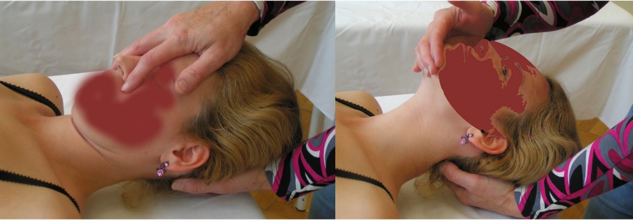 A felső nyaki szakasz passzív flefiós (1. kép) és extenziós (2. kép) mozgásterjedelem vizsgálata