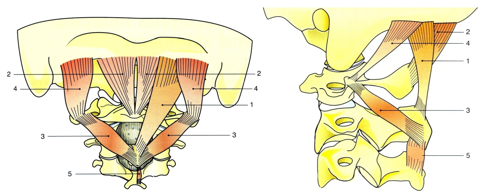 A suboccipitális extenzorok: m. rectus capitis posterior minor (2), m. rectus capitis posterior major (1), m. obliquus capitis superior (4), m. obliquus capitis inferior (3) 