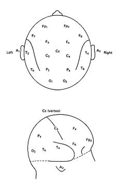 EEG elektródok elhelyezése