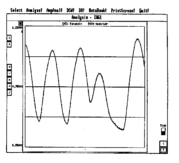 Elektromos ingerek hatása a szív működésére