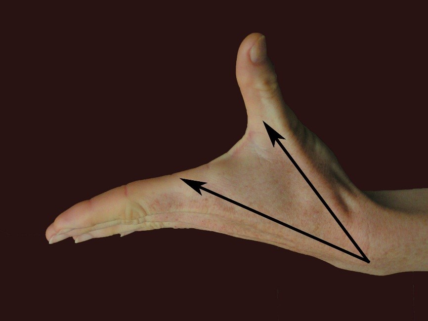 A hüvelykujj  aktív abdukciós mozgásterjedelme.  A hüvelykujj a saját ferde síkjában távolodik a II-es ujjtól. A mozgásterjedelmet az I-es és II-es metacarpus által bezárt szög mutatja.